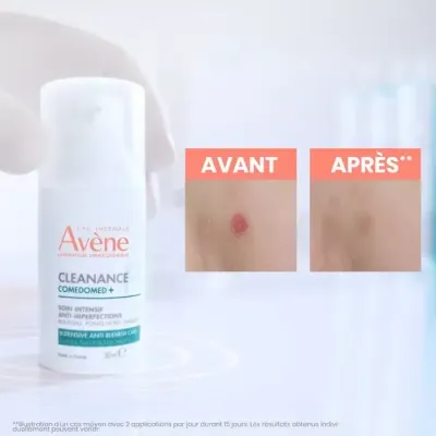 AVENE CLEANANCE COMEDOMED CONCENTRE ANTI IMPERFECTION 30ML AVENE CLEANANCE COMEDOMED CONCENTRE ANTI IMPERFECTION 30ML