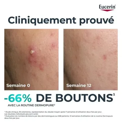 EUCERIN DERMOPURE SERUM TRIPLE ACTION 40ML EUCERIN DERMOPURE SERUM TRIPLE ACTION 40ML