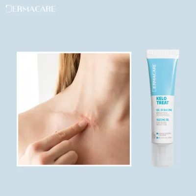 DERMACARE KELO TREAT 15ML DERMACARE KELO TREAT 15ML